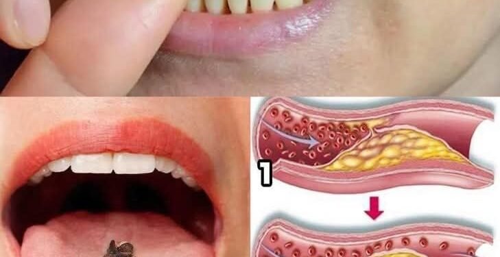 Cloves: 10 Health Benefits of Eating 2 Daily