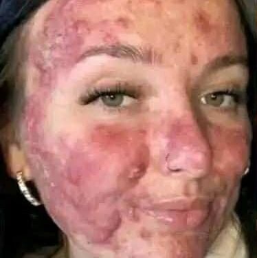Her body was itchy, he thought it was an allergy