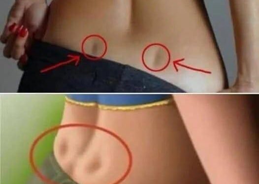 Uncategorized What Those Two Dips on Your Lower Back Are Commonly Called