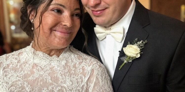 I Married a Blind Man So He’d Never See My Scars – On Our Wedding Night, He Said, ‘You Need to Know the Truth I’ve Been Hiding for 20 Years’