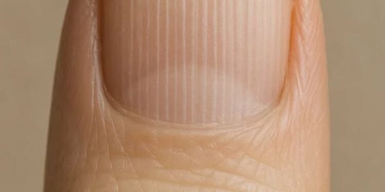 What Those Vertical Lines on Your Nails May Actually Mean as You Get Older