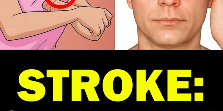 ONE MONTH BEFORE A STROKE, YOUR BODY MAY SEND THESE WA:RNING SIGNS — AND THEY CAN BE DIFFERENT FOR MEN AND WOMEN