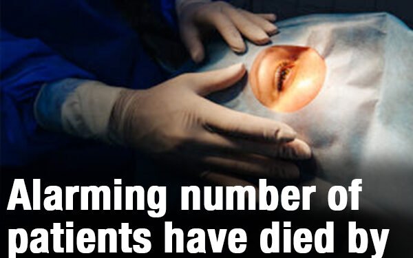 Alarming number of patients have died by suicide after Lasik eye surgery