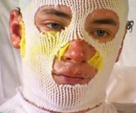 Uncle left with third-degree burns after running into burning building to save 8-year-old girl