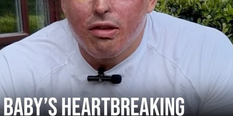 Baby’s heartbreaking reaction to seeing dad for first time after horrific acid attack