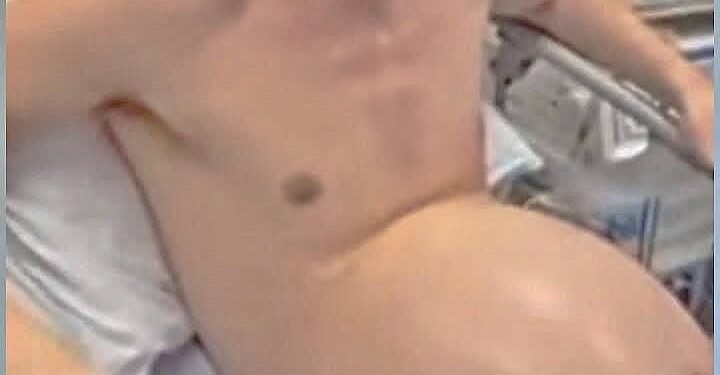 When His Belly Suddenly Rose