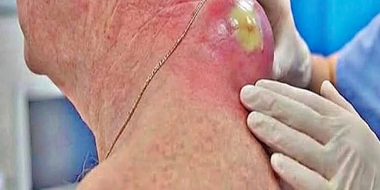 What Is Growing on My Back?