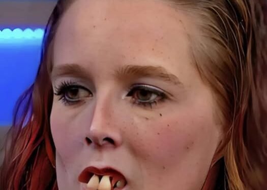 A few years ago, this woman became popular on social media because of her appearance 🤔. Due to the condition of her teeth, many criticized and mocked her 😲. But it was precisely because of this that famous dentists noticed her and offered her a free procedure 😲. Thanks to this, her smile and overall appearance changed dramatically, and now she looks much more beautiful 😍. Are you curious to see how this girl looks today?