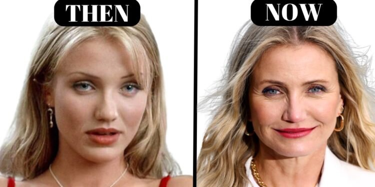 Aging gracefully is the true beauty — more powerful than any plastic or Botox ❤️