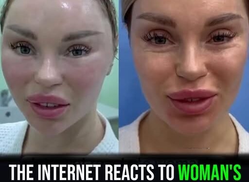 Russian woman’s plastic surgery results spark wide debate on social media