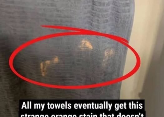 Why Mysterious Orange or Bleached-Looking Stains Keep Appearing on Your Towels, What Everyday Skincare Ingredients Like Benzoyl Peroxide Are Really Doing to Your Fabrics, and the Simple, Practical Ways You Can Prevent, Fix, and Stop Ruining Your Towels Without Giving Up Your Acne Routine