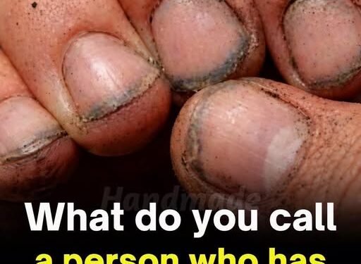 What Dirty Fingernails Really Reveal