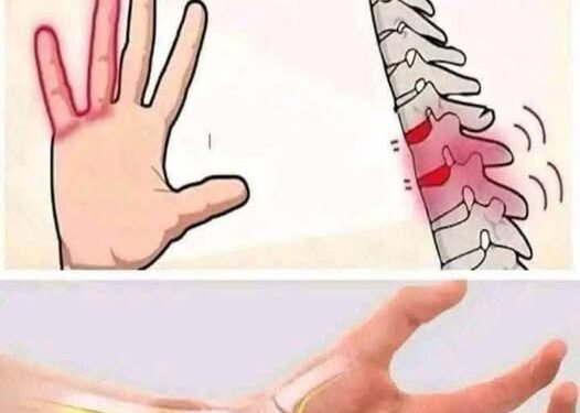 Reasons why you might be waking up with tingling hands