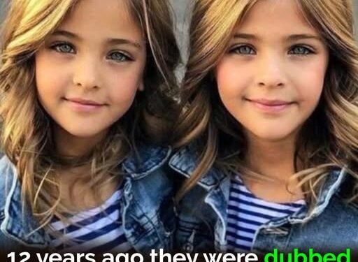 They called them the world’s most beautiful twins 10 years ago – but now look what the girls look like today