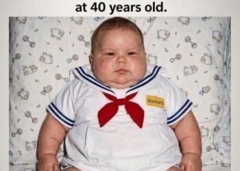 The 7 kilo baby who amazed the world in 1983: this is how it looks today, at the age of 40…